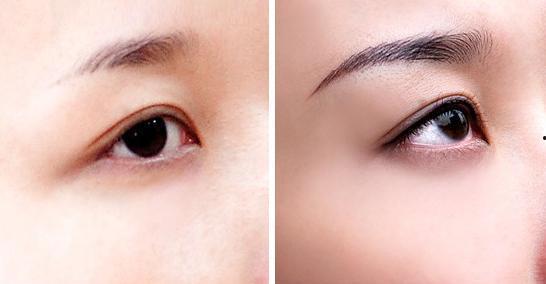 做完纹眉可以吃泡鸡瓜吗,泡鸡瓜可否食用？