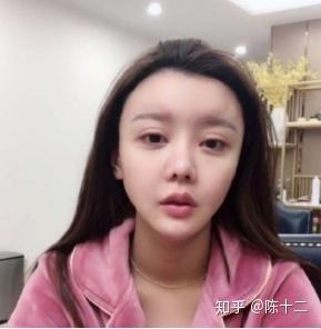 明星原料有哪些,引领时尚潮流的护肤秘籍